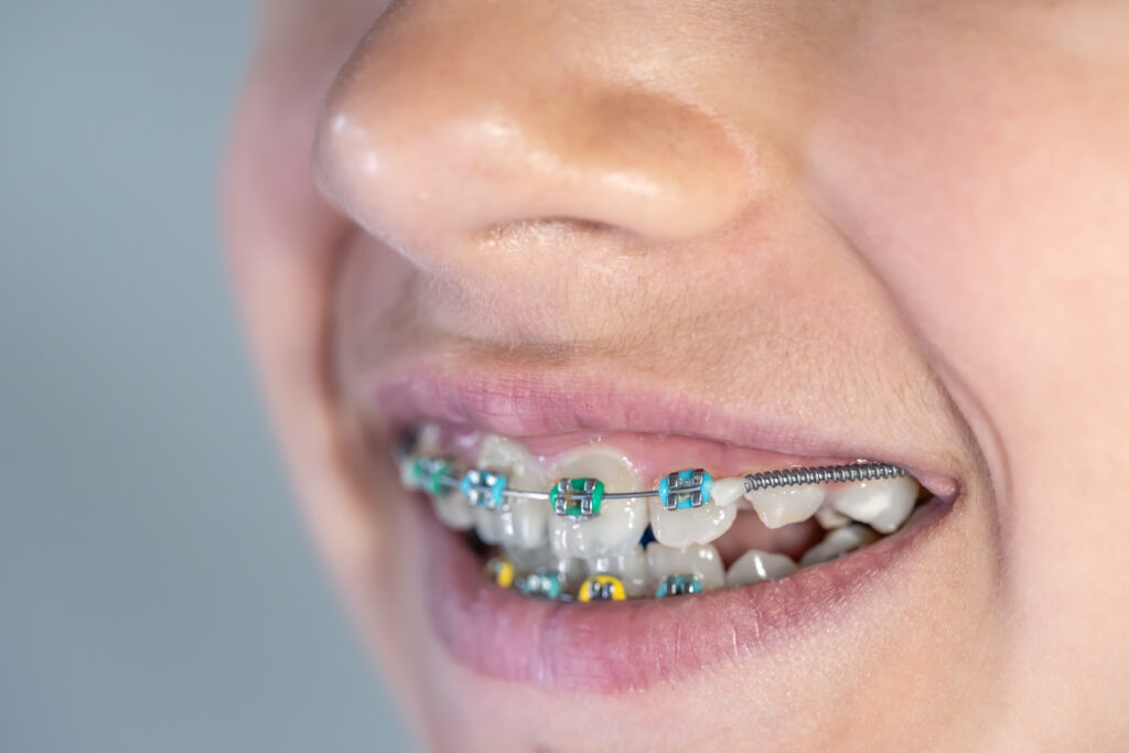 orthodonti